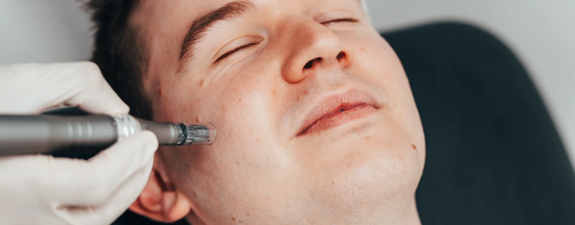 Nueroot skin treatment hero image